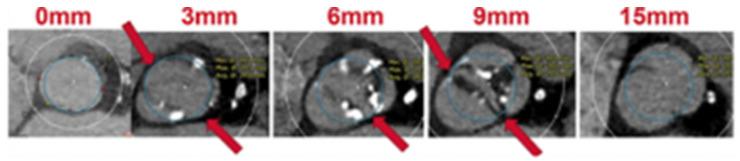 https://cdn.ncbi.nlm.nih.gov/pmc/blobs/6137/10672483/ed885dd06fae/jcm-12-07074-g003.jpg