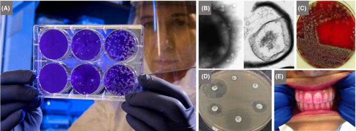 https://cdn.ncbi.nlm.nih.gov/pmc/blobs/613a/7264897/17e06d9b72db/MBT2-13-844-g007.jpg