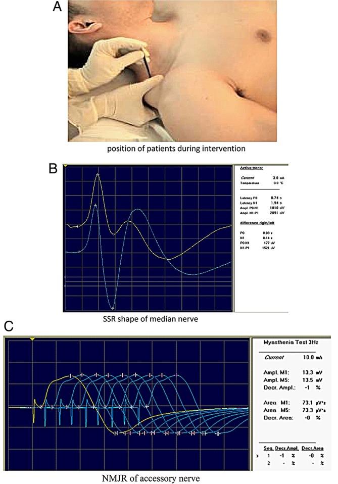 https://cdn.ncbi.nlm.nih.gov/pmc/blobs/613b/5466920/06db5e8a282c/acupmed-2016-011082f02.jpg