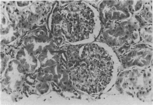 https://cdn.ncbi.nlm.nih.gov/pmc/blobs/6141/1714567/51cd65aa77dd/brmedj00044-0047-a.jpg