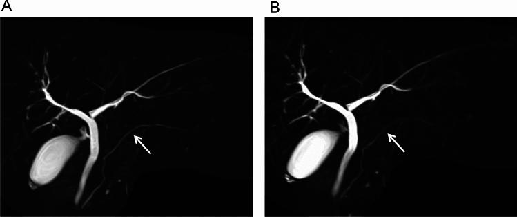 https://cdn.ncbi.nlm.nih.gov/pmc/blobs/6142/11868363/1346969f12d6/11604_2024_1688_Fig5_HTML.jpg
