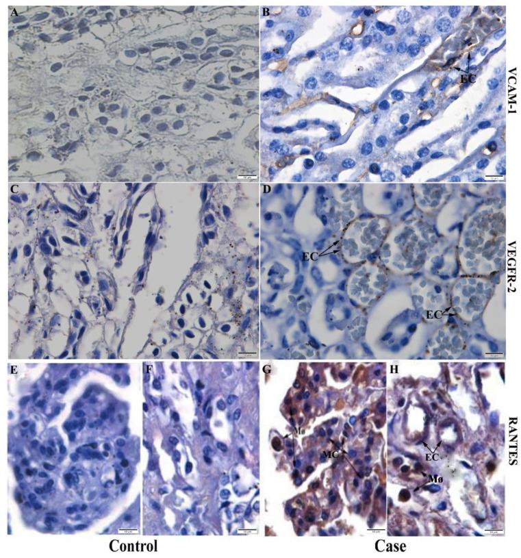 https://cdn.ncbi.nlm.nih.gov/pmc/blobs/6142/9785549/61f5c82a6306/pathogens-11-01543-g007.jpg