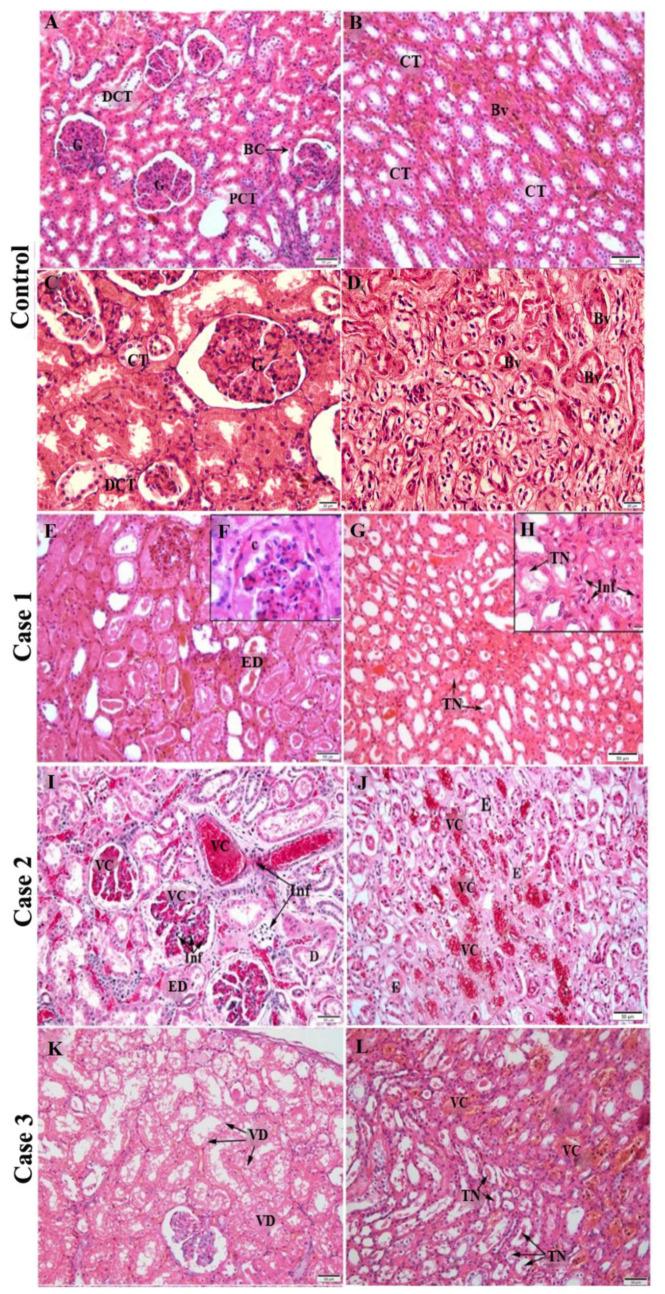 https://cdn.ncbi.nlm.nih.gov/pmc/blobs/6142/9785549/f69ddef56b54/pathogens-11-01543-g001.jpg