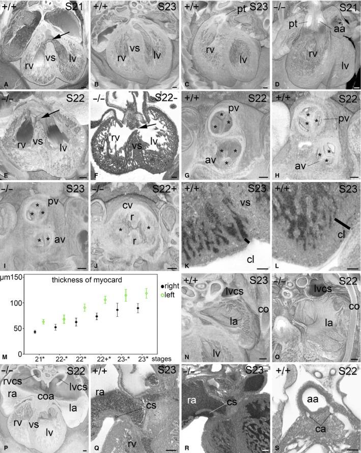 https://cdn.ncbi.nlm.nih.gov/pmc/blobs/6143/5603791/1d2868c78672/JOA-231-600-g001.jpg