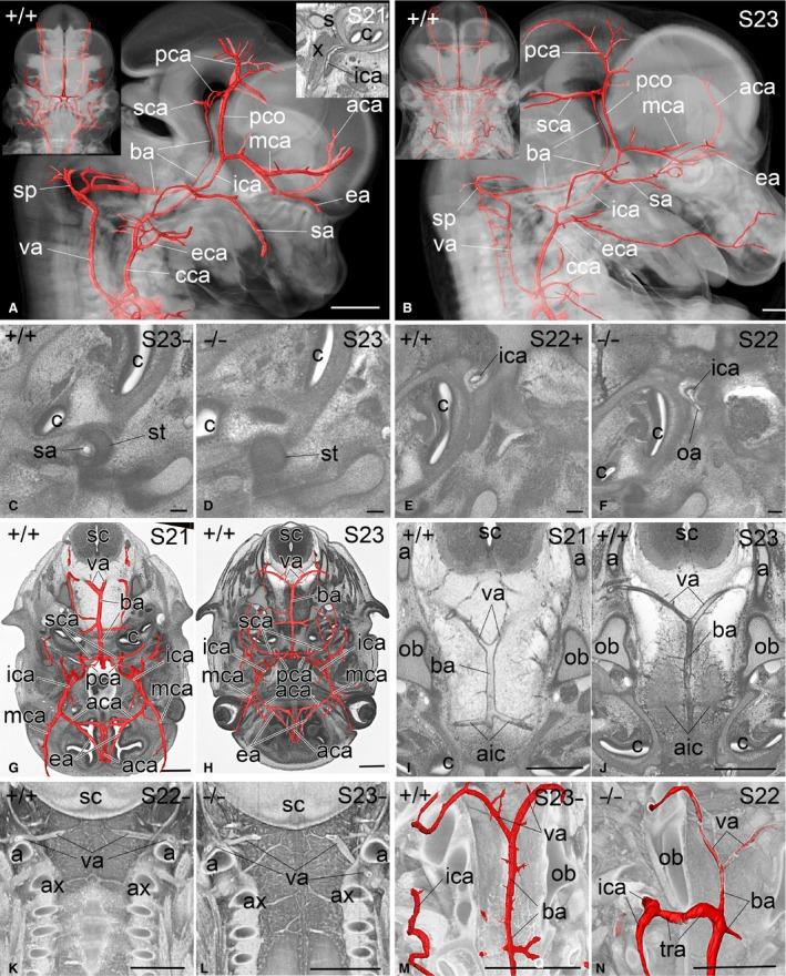 https://cdn.ncbi.nlm.nih.gov/pmc/blobs/6143/5603791/26df73cf6b2f/JOA-231-600-g003.jpg