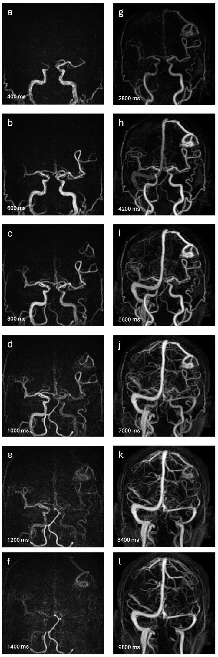 https://cdn.ncbi.nlm.nih.gov/pmc/blobs/6148/11311491/ca7f00e12645/diagnostics-14-01656-g001.jpg