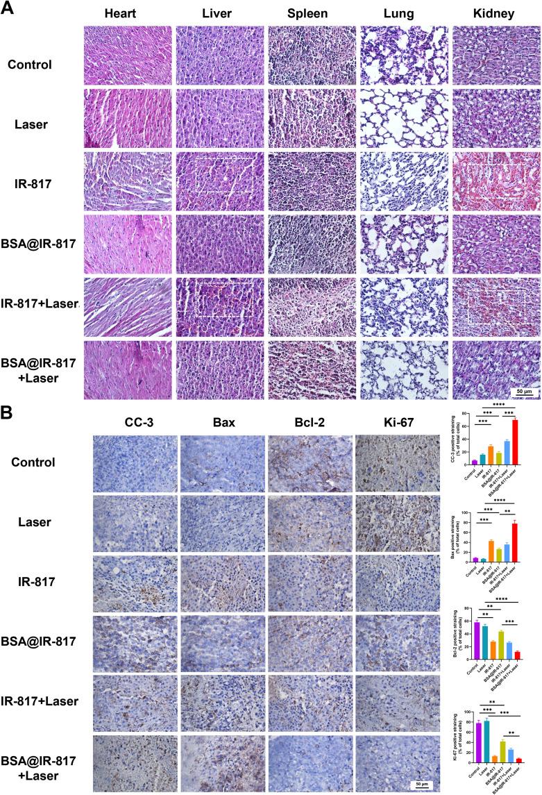 https://cdn.ncbi.nlm.nih.gov/pmc/blobs/6151/10488832/d67b4b4def91/IJN-18-4949-g0008.jpg