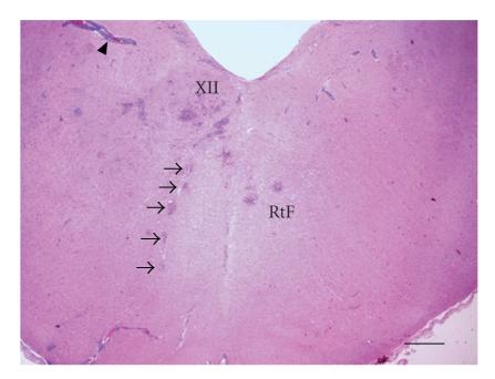 https://cdn.ncbi.nlm.nih.gov/pmc/blobs/6154/2829626/64c038d15534/IPID2010-632513.003.jpg