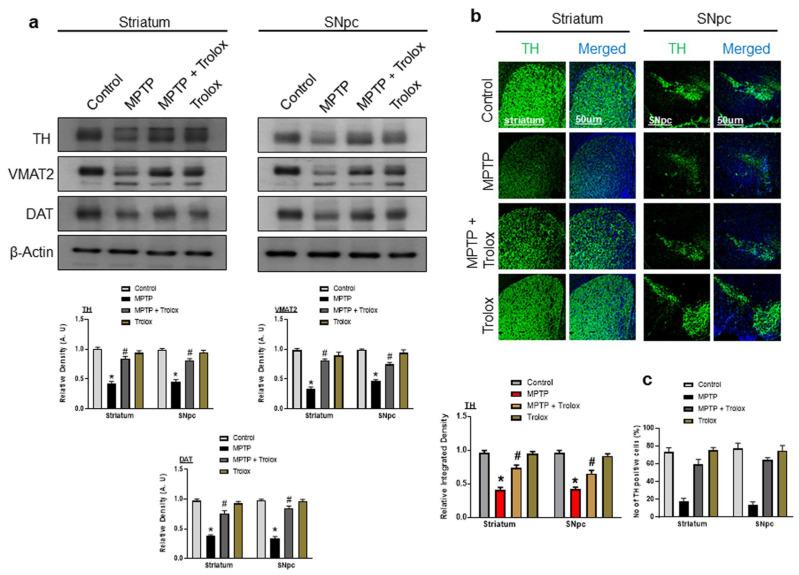 https://cdn.ncbi.nlm.nih.gov/pmc/blobs/615d/10298414/e73c3e7b0a29/ijms-24-09942-g003.jpg