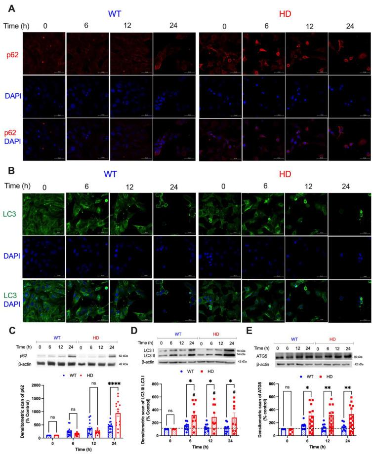 https://cdn.ncbi.nlm.nih.gov/pmc/blobs/615f/10139096/09ec2315c5e7/ijms-24-07178-g005.jpg