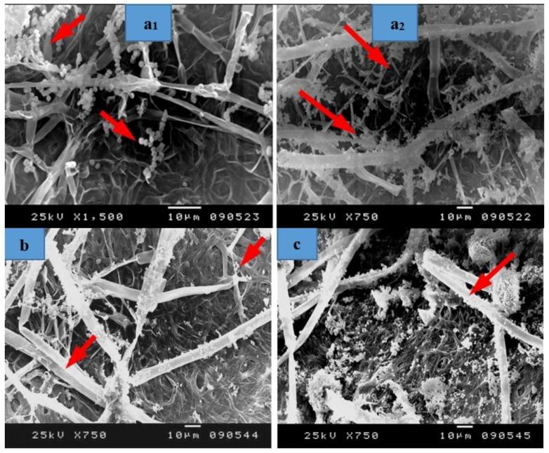 https://cdn.ncbi.nlm.nih.gov/pmc/blobs/615f/6416636/ca23d82aad5c/materials-12-00620-g009a.jpg