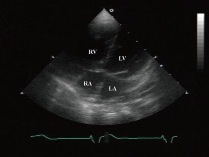 https://cdn.ncbi.nlm.nih.gov/pmc/blobs/6168/3282215/207253db0591/kjped-55-24-g004.jpg
