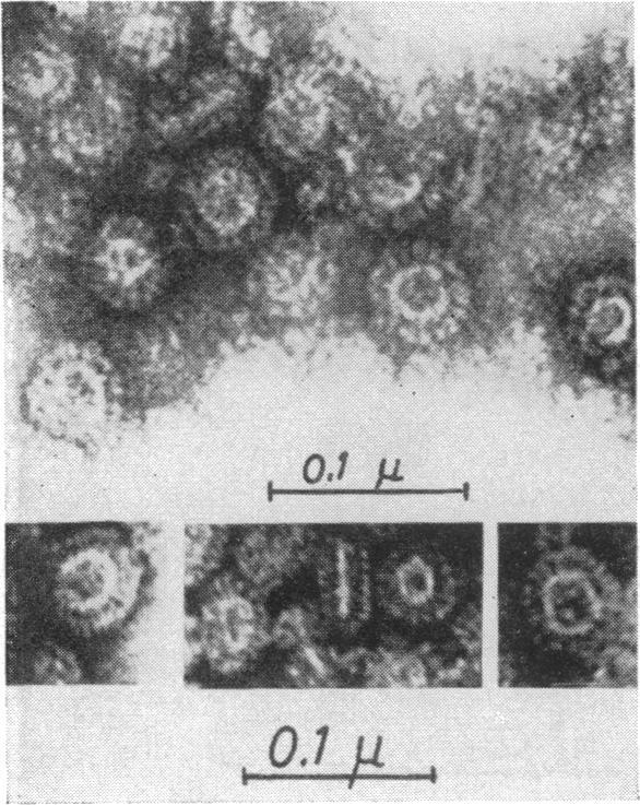 https://cdn.ncbi.nlm.nih.gov/pmc/blobs/616b/441167/a0f75d7db524/bactrev00136-0010-b.jpg