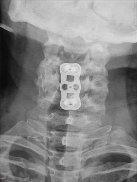 https://cdn.ncbi.nlm.nih.gov/pmc/blobs/616b/8202375/53955e0639af/AJNS-16-187-g007.jpg
