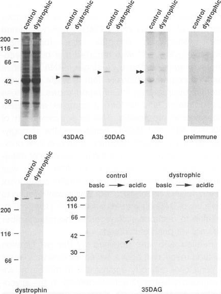 https://cdn.ncbi.nlm.nih.gov/pmc/blobs/616f/1869857/3940853a1ac2/amjpathol00050-0246-b.jpg