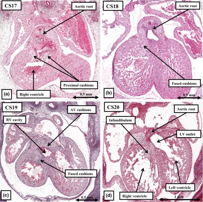 https://cdn.ncbi.nlm.nih.gov/pmc/blobs/6171/11424819/738ca46ab5c9/JOA-245-517-g010.jpg