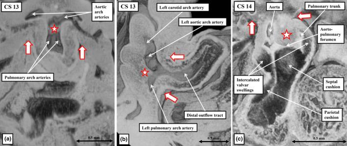 https://cdn.ncbi.nlm.nih.gov/pmc/blobs/6171/11424819/c4c871f4ce58/JOA-245-517-g017.jpg