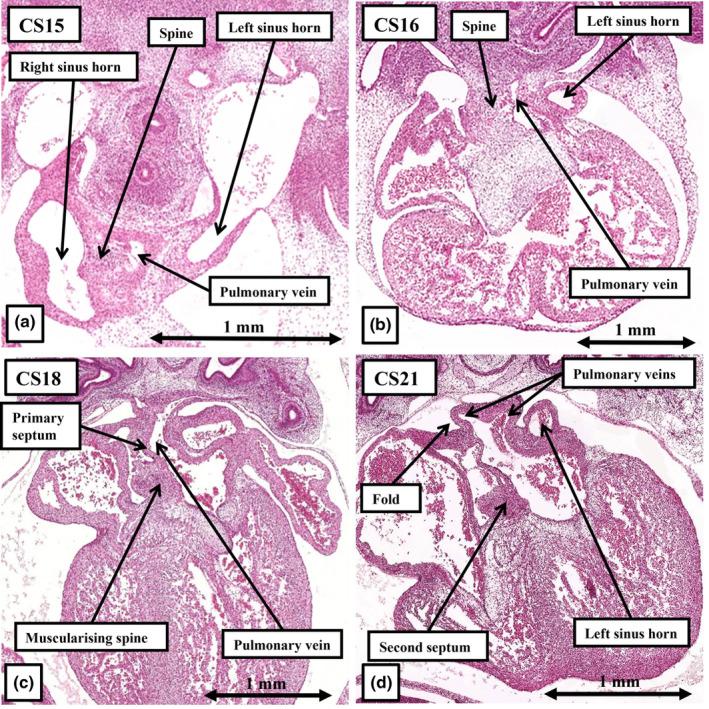 https://cdn.ncbi.nlm.nih.gov/pmc/blobs/6171/11424819/cdaf23e6a12c/JOA-245-517-g003.jpg