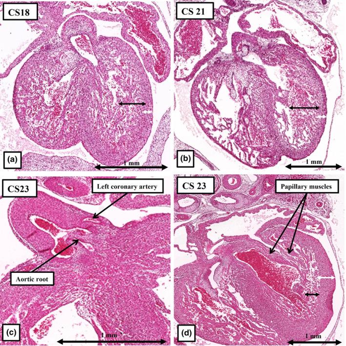https://cdn.ncbi.nlm.nih.gov/pmc/blobs/6171/11424819/df55ec2f0fe8/JOA-245-517-g009.jpg