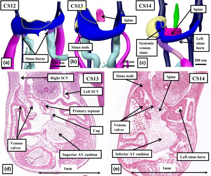 https://cdn.ncbi.nlm.nih.gov/pmc/blobs/6171/11424819/e83e19d7fe83/JOA-245-517-g001.jpg