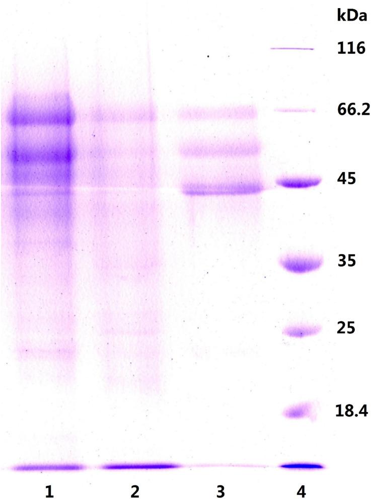 https://cdn.ncbi.nlm.nih.gov/pmc/blobs/6177/8116588/ea6d577e7a14/fbioe-09-679720-g003.jpg