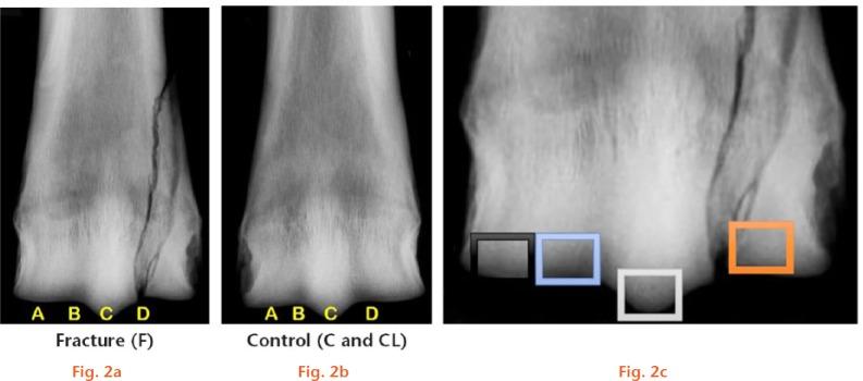 https://cdn.ncbi.nlm.nih.gov/pmc/blobs/6179/5805827/dc2e2eda6577/bonejointres-07-94-g002.jpg