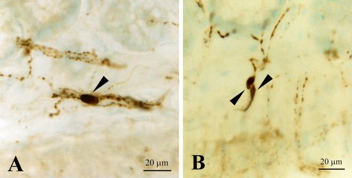 https://cdn.ncbi.nlm.nih.gov/pmc/blobs/6185/5765215/15169fbbc29b/AHC17015f05.jpg