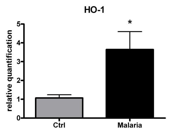 https://cdn.ncbi.nlm.nih.gov/pmc/blobs/618b/2858213/0fcbf9cec03f/1475-2875-9-81-7.jpg