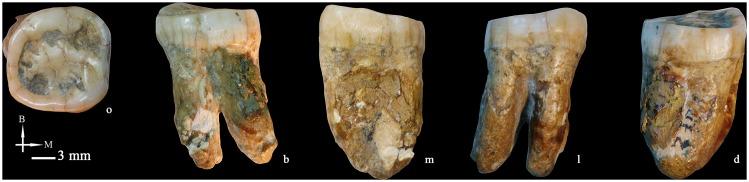 https://cdn.ncbi.nlm.nih.gov/pmc/blobs/6192/4281145/353abe4ab9f6/pone.0114265.g011.jpg