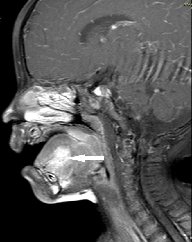 https://cdn.ncbi.nlm.nih.gov/pmc/blobs/6196/9846346/12bd920995d8/fonc-12-934882-g002.jpg