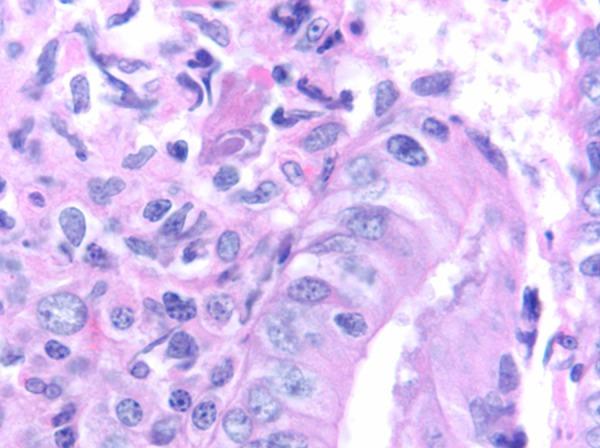 https://cdn.ncbi.nlm.nih.gov/pmc/blobs/6199/4968430/18d7ca195143/amjcaserep-17-538-g002.jpg