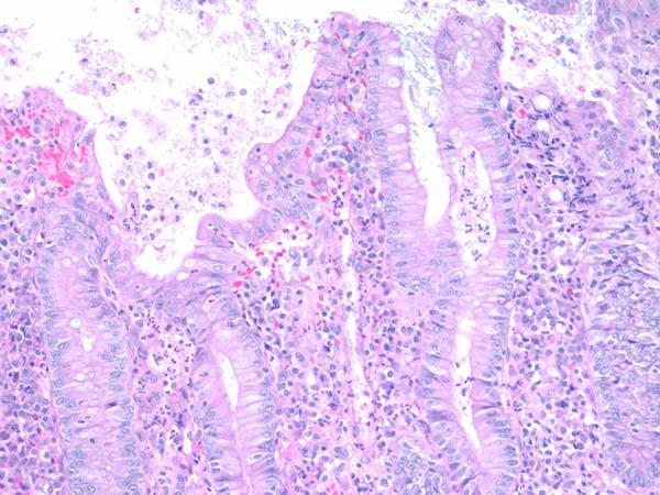 https://cdn.ncbi.nlm.nih.gov/pmc/blobs/6199/4968430/5e0e682b89e3/amjcaserep-17-538-g001.jpg