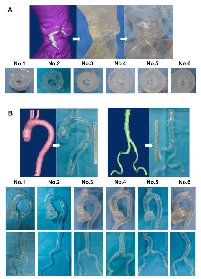 https://cdn.ncbi.nlm.nih.gov/pmc/blobs/619b/10816599/8c919bd3f1a5/jcdd-11-00022-g010a.jpg