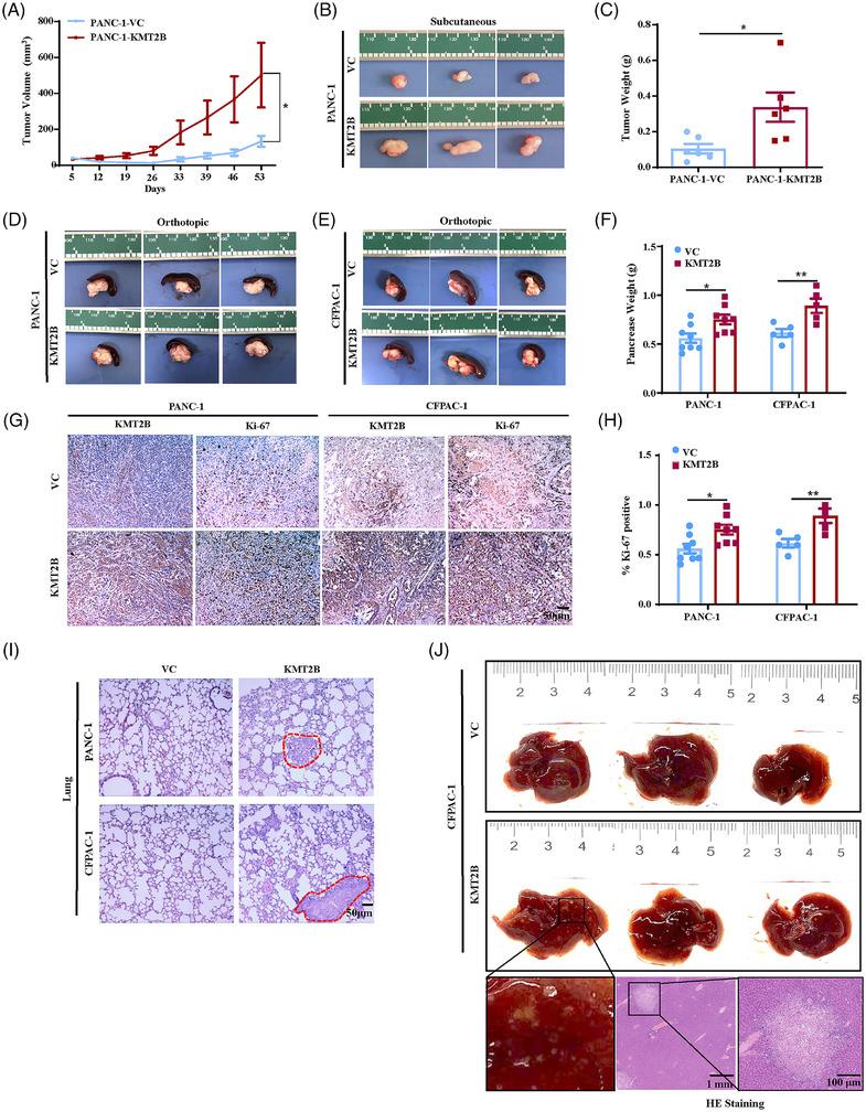 https://cdn.ncbi.nlm.nih.gov/pmc/blobs/619b/12311841/c00f953f5293/CTM2-15-e70424-g002.jpg