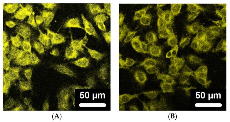 https://cdn.ncbi.nlm.nih.gov/pmc/blobs/61a2/10529957/cdc040dd623f/gels-09-00762-g008a.jpg