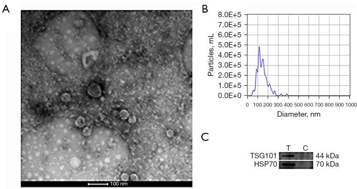 https://cdn.ncbi.nlm.nih.gov/pmc/blobs/61a3/12082201/94d05ffd8716/tlcr-14-04-1138-f1.jpg