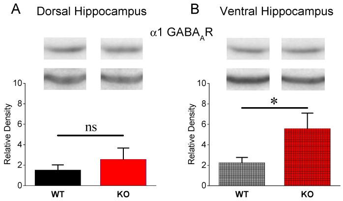 https://cdn.ncbi.nlm.nih.gov/pmc/blobs/61a4/10669536/d6674221f97b/brainsci-13-01598-g003.jpg