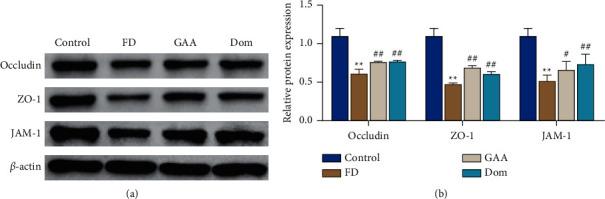 https://cdn.ncbi.nlm.nih.gov/pmc/blobs/61aa/9173975/68169bbbf9a6/ECAM2022-2298665.004.jpg