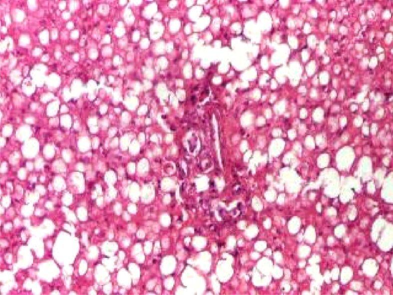 https://cdn.ncbi.nlm.nih.gov/pmc/blobs/61c5/8343491/c3733788119b/RJME-61-4-1023-fig4.jpg