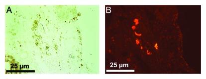 https://cdn.ncbi.nlm.nih.gov/pmc/blobs/61c7/3341243/c53561927a2d/spmg-2-23-g1.jpg