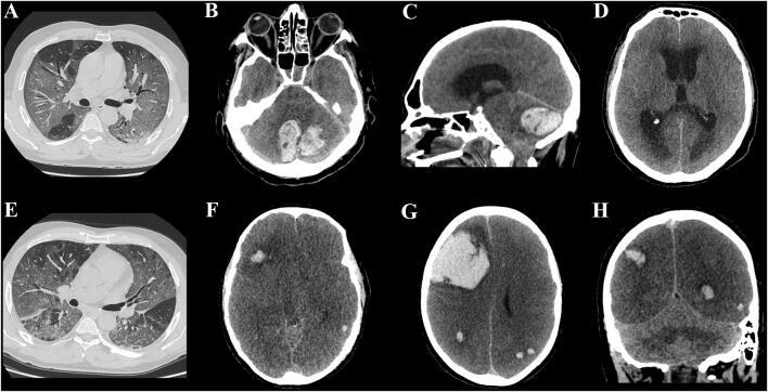 https://cdn.ncbi.nlm.nih.gov/pmc/blobs/61cd/7238403/d53cd950cc0e/415_2020_9885_Fig3_HTML.jpg