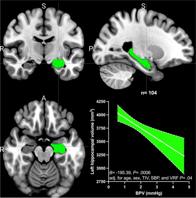 https://cdn.ncbi.nlm.nih.gov/pmc/blobs/61d8/11872826/21b09135fe83/11357_2024_1303_Fig1_HTML.jpg