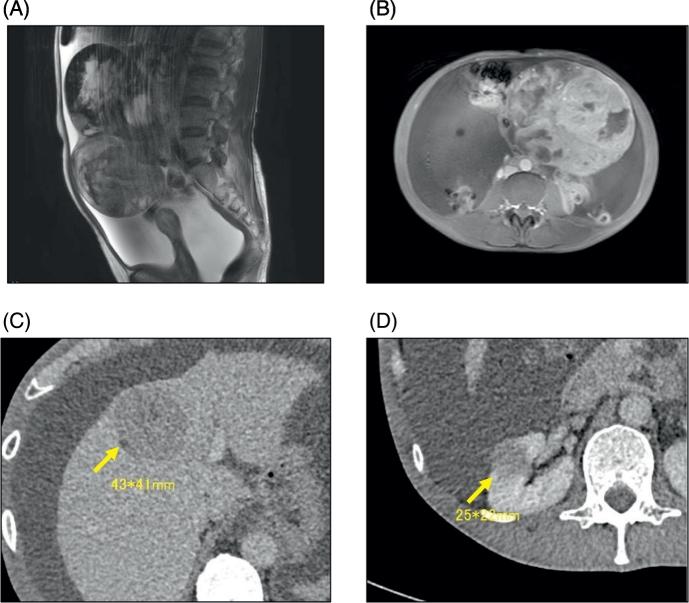 https://cdn.ncbi.nlm.nih.gov/pmc/blobs/61d9/5760241/972f4331a076/gr1.jpg