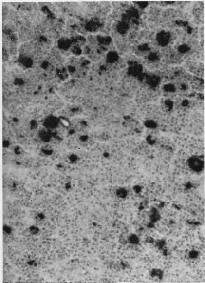 https://cdn.ncbi.nlm.nih.gov/pmc/blobs/61da/480576/a00eaa11d68b/jclinpath00075-0063-a.jpg