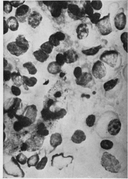 https://cdn.ncbi.nlm.nih.gov/pmc/blobs/61da/480576/a0b315085d77/jclinpath00075-0061-b.jpg