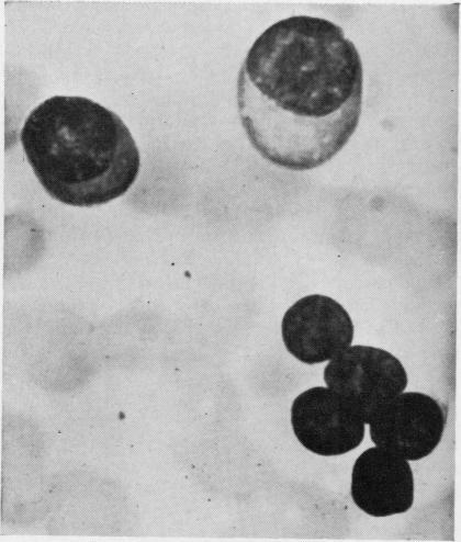 https://cdn.ncbi.nlm.nih.gov/pmc/blobs/61da/480576/de6a21d792e3/jclinpath00075-0061-d.jpg