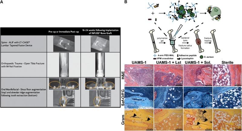 https://cdn.ncbi.nlm.nih.gov/pmc/blobs/61e1/7040483/ef6d3a288f15/fbioe-08-00069-g003.jpg