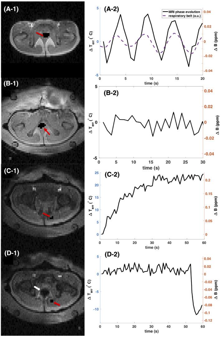 https://cdn.ncbi.nlm.nih.gov/pmc/blobs/61e6/7402020/20d4e74f6dcb/MRM-84-2495-g003.jpg