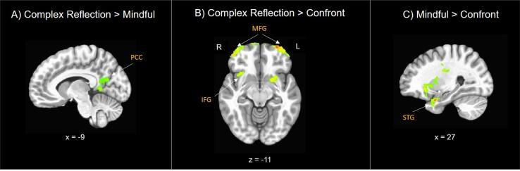 https://cdn.ncbi.nlm.nih.gov/pmc/blobs/61ec/8850747/0b3e06334509/gr5.jpg