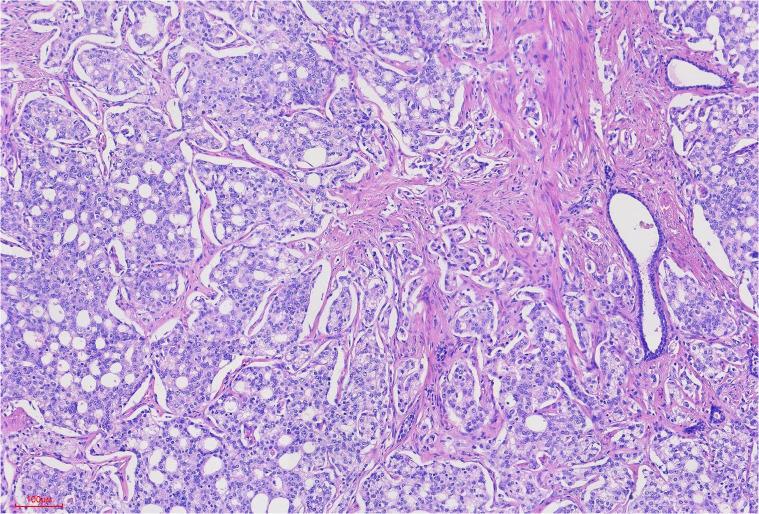 https://cdn.ncbi.nlm.nih.gov/pmc/blobs/61f5/12183169/4ef77f295c37/fonc-15-1605846-g004.jpg
